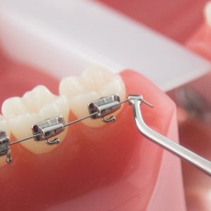 INSTRUMENTO DOBLADOR DE ARCOS POR DISTAL (.030")